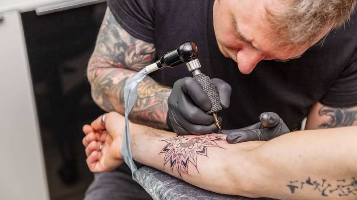 Tattoo Removal in New York City
